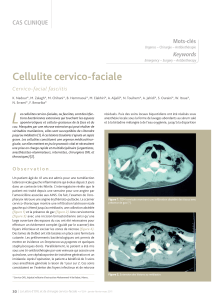 Cellulite cervico-faciale CAS CLINIQUE Keywords
