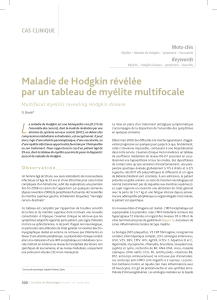 L Maladie de Hodgkin révélée par un tableau de myélite multifocale CAS CLINIQUE