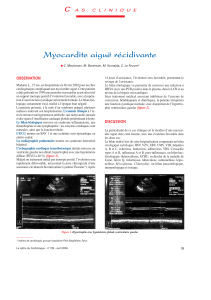 Myocardite aiguë récidivante C OBSERVATION