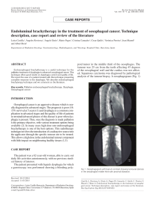 Endoluminal brachytherapy in the treatment of oesophageal cancer. Technique