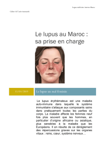 Le lupus  au Maroc sa prise en charge
