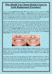 Why Should You Choose Dental Crown As Teeth Replacement Procedure