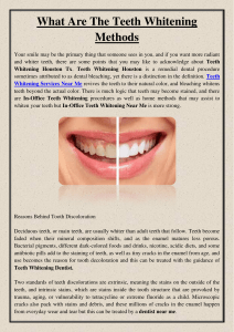What Are The Teeth Whitening Methods