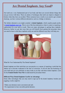 Are Dental Implants Any Good