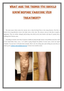 What are the things you should know before varicose vein treatment