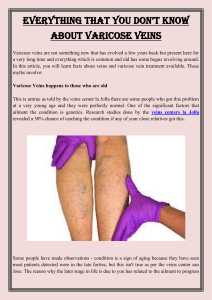 Everything That You Don’t Know About Varicose Veins