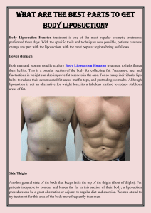 What are the best parts to get Body Liposuction