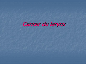 cancer du larynx
