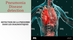 Pneumonia Disease detection