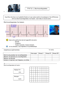 TP 1 La santé * L`électrocardiogramme