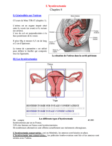 2) L`hystérectomie vaginale