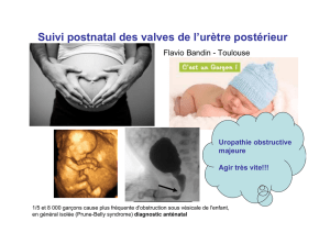 Suivi postnatal des valves de l`urètre postérieur