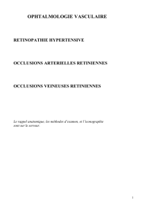 Retinopathie hypertensive,OACR,OVCR