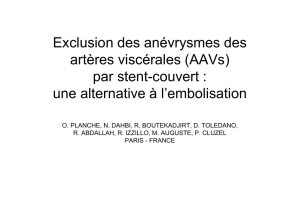 Exclusion des anévrysmes des artères viscérales (AAVs) par stent