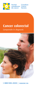 Cancer colorectal : Comprendre le diagnostic
