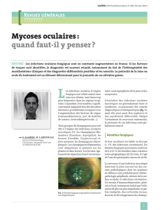 Mycoses oculaires : quand faut-il y penser ?