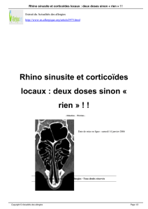 Rhino sinusite et corticoïdes locaux : deux doses