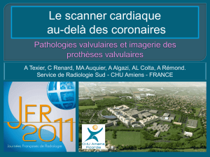 Diagnostic au scanner - Société Française de radiologie