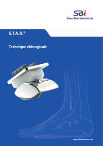 AutoFIX Product Brochure