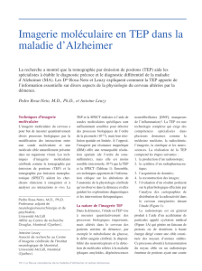 Imagerie moléculaire en TEP dans la maladie d`Alzheimer