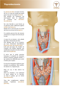 Thyroïdectomie