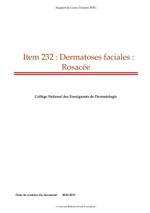 Item 232 : Dermatoses faciales : Rosacée