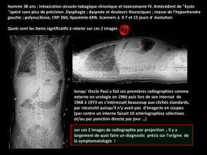 D CJ thorax colllections médiastinales d`origine