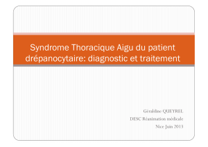 Syndrome Thoracique Aigu du patient drépanocytaire