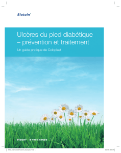 Ulcères du pied diabétique – prévention et