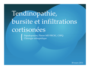 Tendinopathie Tendinopathie, bursite et infiltrations cortisonées