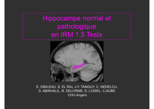Hippocampe normal et pathologique en IRM 1.5 Tesla