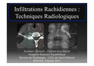 Infiltrations Rachidiennes : Techniques Radiologiques
