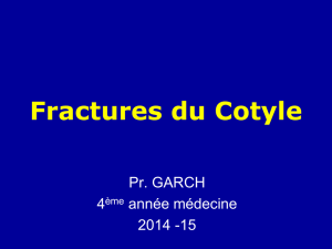 Fractures du Cotyle