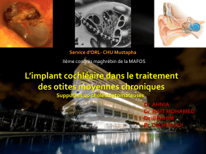 L`implant cochléaire dans le traitement des otites