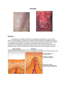 Psoriasis