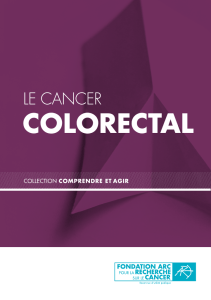 Le cancer colorectal