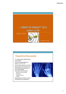 "Treat to Target" dans la PR - B. Coustet - rhumatologie
