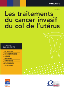 Les traitements du cancer invasif du col de l`utérus