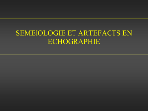 5 Echographie - Séméiologie et Artéfacts - Pr Grenier