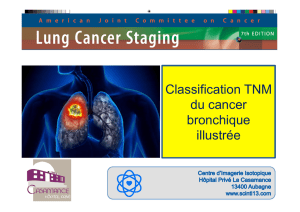 1. Classification TNM illustrée du cancer bronchique