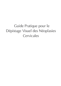Guide Pratique pour le Dépistage Visuel des Néoplasies Cervicales