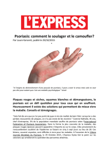L`Express - Psoriasis : comment le soulager et le camoufler