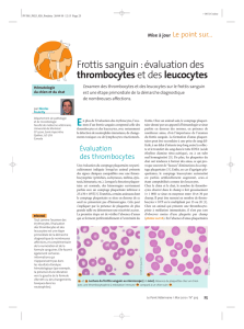Frottis sanguin: évaluation des thrombocytes et des