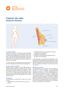 Cancer du sein - Carcinome mammaire (pdf, 264 Ko)