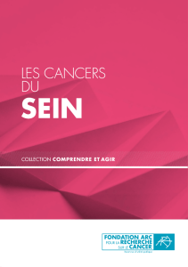 Les cancers du sein