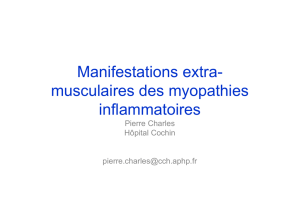 Manifestations extra- musculaires des myopathies inflammatoires