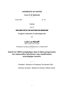 Intérêt de l`IRM encéphalique dans le bilan préopératoire des
