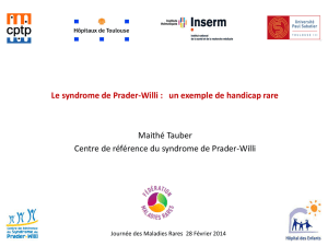 Le syndrome de Prader-Willi une exemple de handicap rare