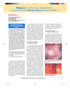 Comment je diagnostique... un syndrome de Zollinger