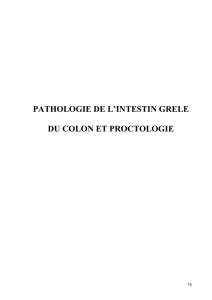 Chap 2 - Grêle